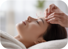美容鍼